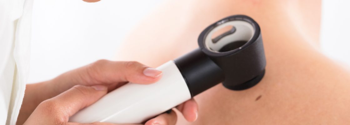 Liga Portuguesa Contra o Cancro realiza rastreios de cancro oral e da pele